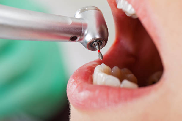 Best Emergency Treatment for Toothache in Homewood, AL
